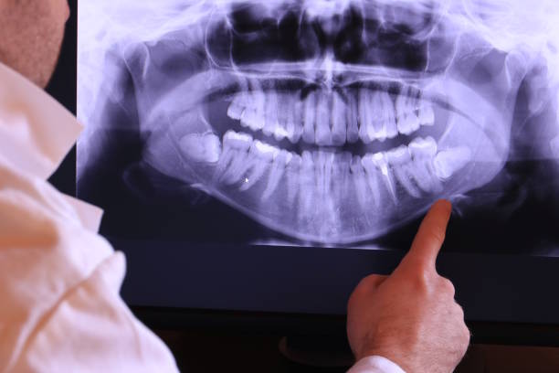 Best Broken or Cracked Tooth Emergency Dentist in Somers Point, NJ